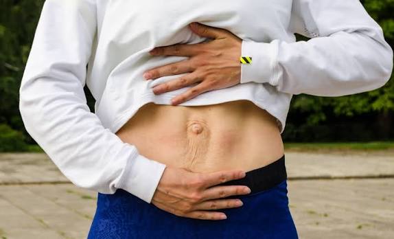 When Could Diastasis Recti Be the Missing Piece of the Puzzle Bradford on Avon?